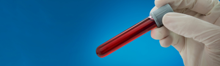 リキッドバイオプシーとは